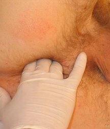 Twink gets medical checkup gay porn 61e1d6f7e05fa.jpg