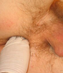 Twink gets medical checkup gay porn 61e1d70467acd.jpg