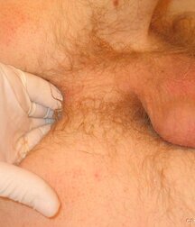 Twink gets medical checkup gay porn 61e1d708ba5cd.jpg