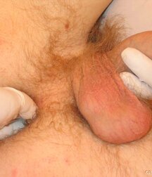 Twink gets medical checkup gay porn 61e1d70abccbc.jpg