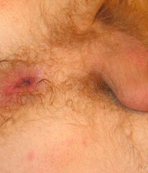 Twink gets medical checkup gay porn 61e1d70e9f48d.jpg