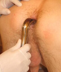 Twink gets medical checkup gay porn 61e1d763ba6fd.jpg