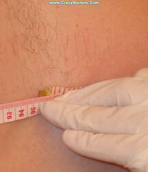 Twink at Doc gay porn medical crazydoctors 62211f57118c6.jpg