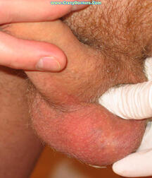 Twink at Doc gay porn medical crazydoctors 62211f69d0b3f.jpg