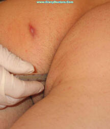 Twink at Doc gay porn medical crazydoctors 62211f998c442.jpg