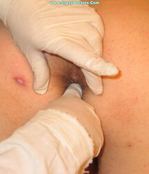 Twink at Doc gay porn medical crazydoctors 62211fa5992e8.jpg