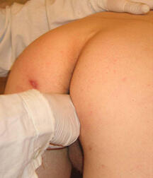 Twink at Doc gay porn medical crazydoctors 62211fa94421d.jpg