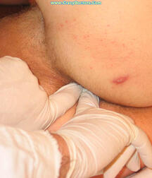 Twink at Doc gay porn medical crazydoctors 62211fca036c9.jpg
