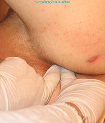 Twink at Doc gay porn medical crazydoctors 62211fcc03436.jpg