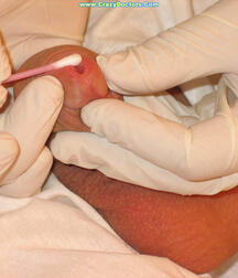 Twink at Doc gay porn medical crazydoctors 62211fe97f546.jpg