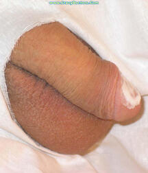 Twink at Doc gay porn medical crazydoctors 62211ff384ebc.jpg