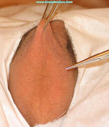 Twink at Doc gay porn medical crazydoctors 62211ffb7e934.jpg