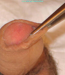 Twink at Doc gay porn medical crazydoctors 62212005afd72.jpg