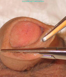 Twink at Doc gay porn medical crazydoctors 6221200a57970.jpg