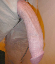 Poking Out 01 5f0d03f077c97.png