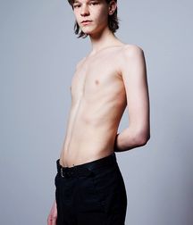 Skinny is Better 5d2214cccc2a3.jpg