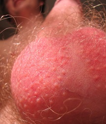 Gayteenred 5d59587f1f4ac.jpg