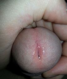 My dick 5c61e045edbff.jpg