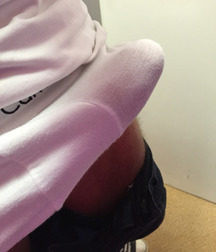 Furry chest and legs, CheekySkin & Jon 5e2733dd6da38.jpg