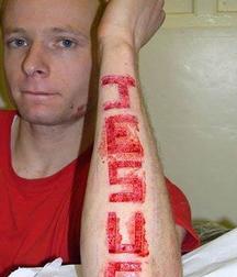 Art, boys, Johan, naked outdoor 5e28b62d9cd36.jpg