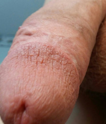 Well Hung Twinks, soft and hard 5e4d65d23fa3c.jpg