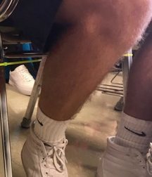 Hairy Legs Love Affair Porn 5e7a3ad7b1030.jpg