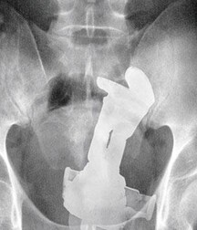 Fun objects in Dude's butts, porn 5f0b6f1f6b0be.jpg