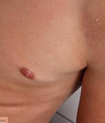 Torflo 5dcaf5cdb22dd.jpg