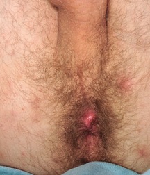 Jack hat Druck und will ficken boys porn 624de6eae92a0.jpg