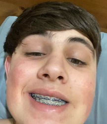 Boys Twinks Gay Porn Young Cute Free 5e77848c95502.jpeg