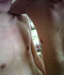 HOT AF - SnotFerret aka Bitemarks 5dc283196ea4c.jpg