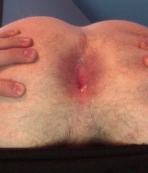 Butts and Holes 35 5e2a4582984b7.jpg