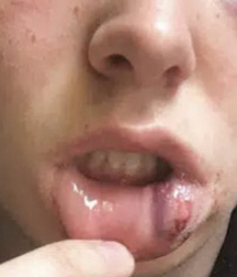 Lips 5ec2110c99c43.jpg