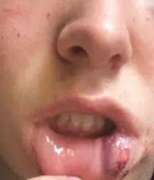 Lips 5ec2113428952.png