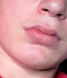Lips 5ec211538e391.jpg
