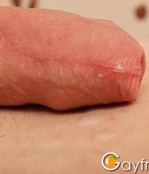 Eryk Foot 5dd5b76c8a8f6.jpg