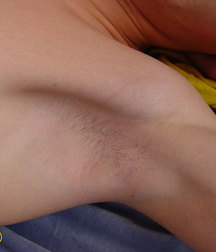 Enzo 5de2d28486e18.jpg