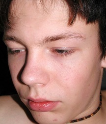 Emil 5dffe6e8235b9.jpg