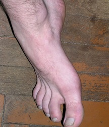 Garik 5e025cc6a8fbc.jpg