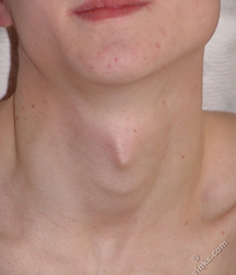 Kusha  5d9ad5798a949.jpg