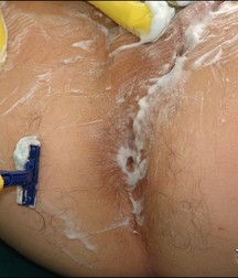 Shaving Ton 5da56a883517e.jpg