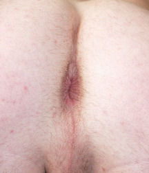 Moriz 5db686bcf2edf.jpg
