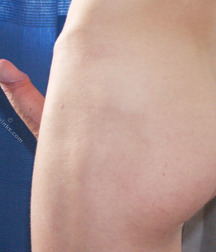 Moriz 5db6882c47a24.jpg