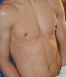 Remi 5dba7fc1650b8.jpg