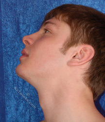Remi 5dba7fc7531e7.jpg