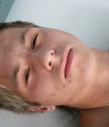 Boy next-door type Carl Twinks Gay Porn 5f8bd42e33ca4.jpg