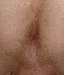 Skinny boy Ashley 5fa239c650746.jpg