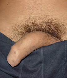 Juanito 2 5ddc33ad4dd94.jpg