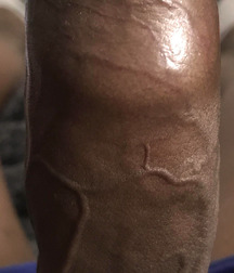 Uncut Black Cocks 5dcf1df0b8da1.jpg