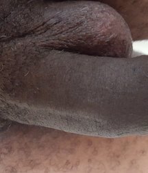 Tasty Black Foreskin 5e02a91542784.jpg